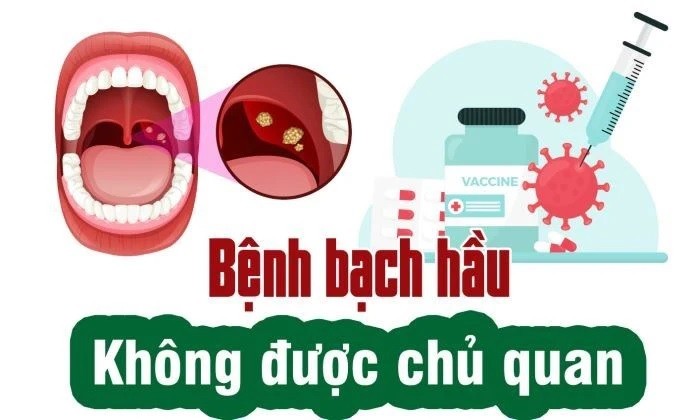 Bệnh Bạch hầu và những điều cần biết