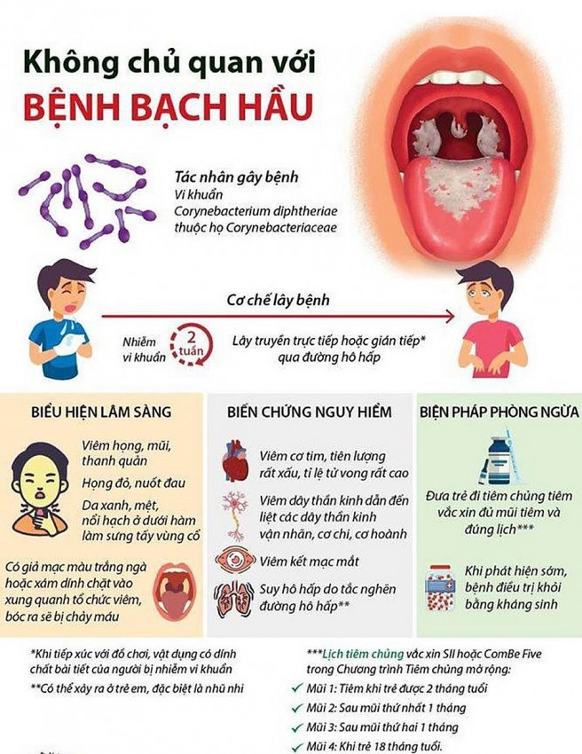 Biểu hiện, biến chứng, cách điều trị bệnh Bạch hầu.