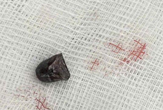 Bắt đối tượng dùng súng tự chế bắn người gây thương tích