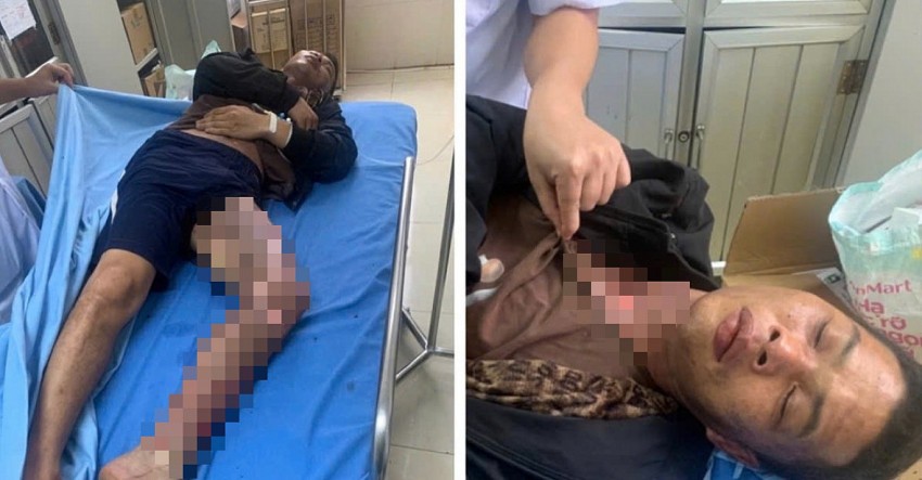 Leo trạm biến áp cắt trộm dây điện, hai người bị bỏng nặng