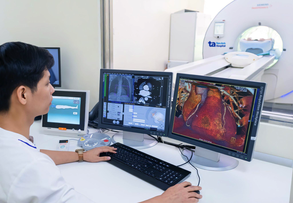 Kỹ thuật viên theo dõi quá trình chụp với “siêu máy” CT hơn 100.000 lát cắt thông qua hình ảnh hiển thị rõ nét trên màn hình máy tính. Ảnh: Bệnh viện Đa khoa Tâm Anh. Kỹ thuật viên theo dõi quá trình chụp với “siêu máy” CT hơn 100.000 lát cắt thông qua hình ảnh hiển thị rõ nét trên màn hình máy tính. Ảnh: Bệnh viện Đa khoa Tâm Anh.