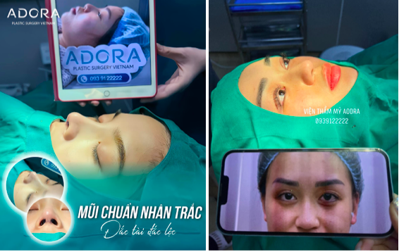 ADORA Plastic Surgery Korea – Địa chỉ làm đẹp chuẩn y khoa, nơi khơi nguồn hành trình thăng hoa nhan sắc của phụ nữ hiện đại