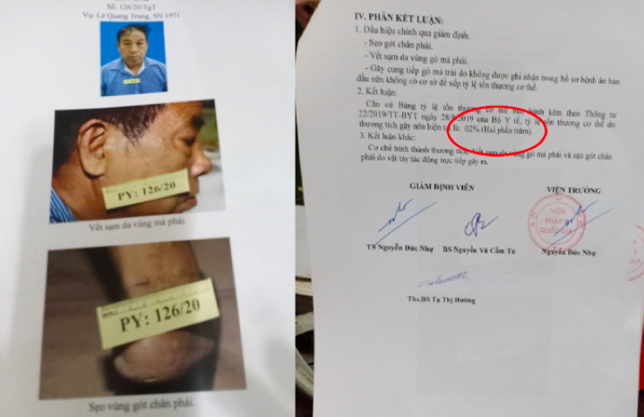 Vụ thương binh bị hành hung, phá hủy tài sản sau nhiều năm vẫn không được giải quyết