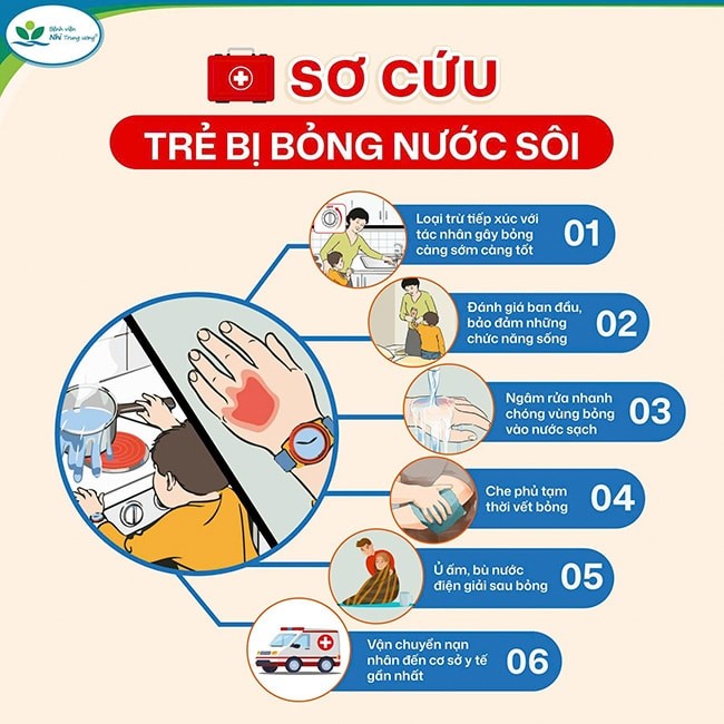 Kịp thời cứu chữa 03 trẻ bị bỏng nặng do gia đình bất cẩn khi ăn lẩu