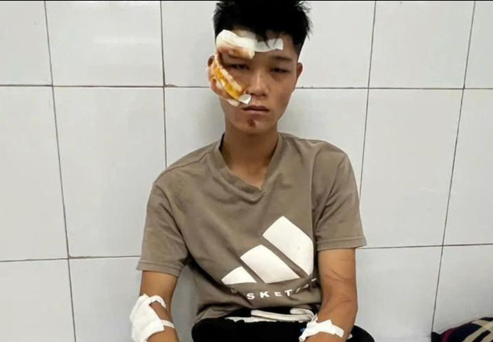 Đối tượng Nguyễn Văn Quân đang được điều trị tại bệnh viện 