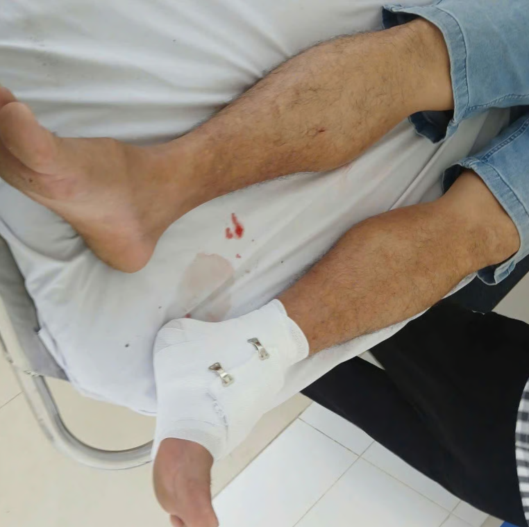 Phạt 315 triệu đồng chủ nuôi cá sấu sổng chuồng tấn công thầy giáo