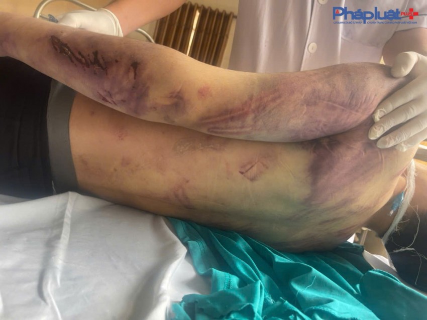 Lời kể đau lòng của người bố có con bị đánh tử vong tại Trung tâm Công tác xã hội Hải Hà-Quảng Ninh