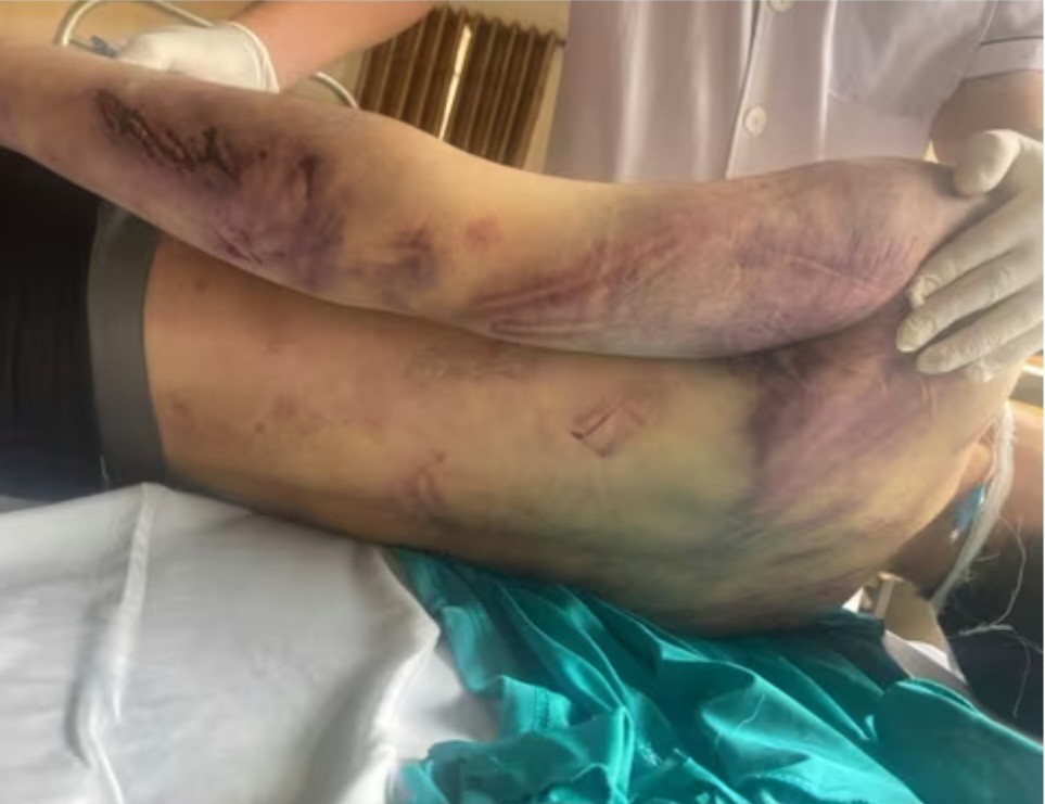 Khởi tố 10 người liên quan đến cái chết của học viên tại Trung tâm Hải Hà