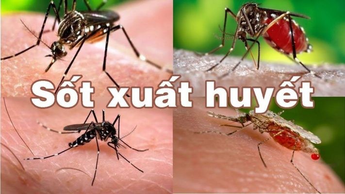 Tình trạng sốt xuất huyết, tay chân miệng đang diễn ra phức tạp.