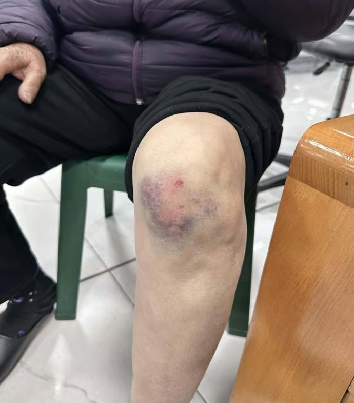 Cụ bà gần 80 tuổi bị phụ xe limousine khu vực bến xe Bãi Cháy hành hung