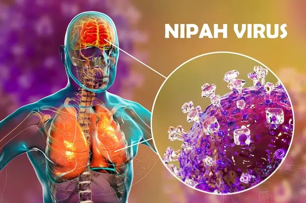 Virus Nipah có thể lây sang người qua nhiều con đường.