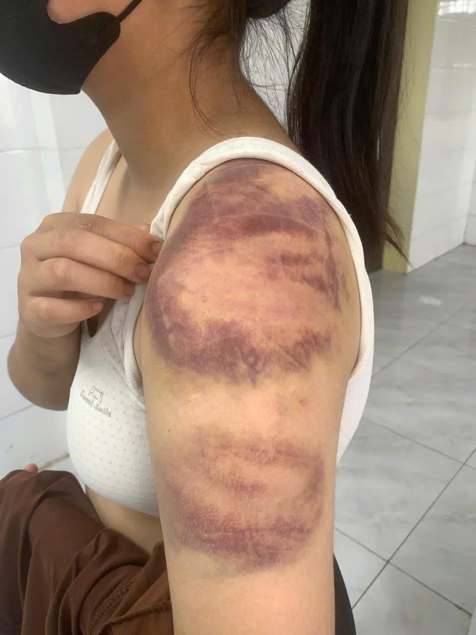 Khởi tố đối tượng hành hạ vợ, con ở Bắc Ninh