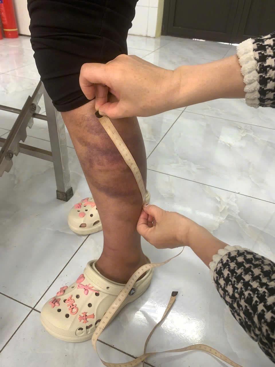 Khởi tố đối tượng hành hạ vợ, con ở Bắc Ninh