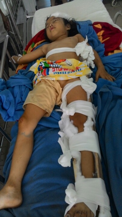 Th&acirc;n thể băng b&oacute; khắp nơi nh&igrave;n rất đau l&ograve;ng.