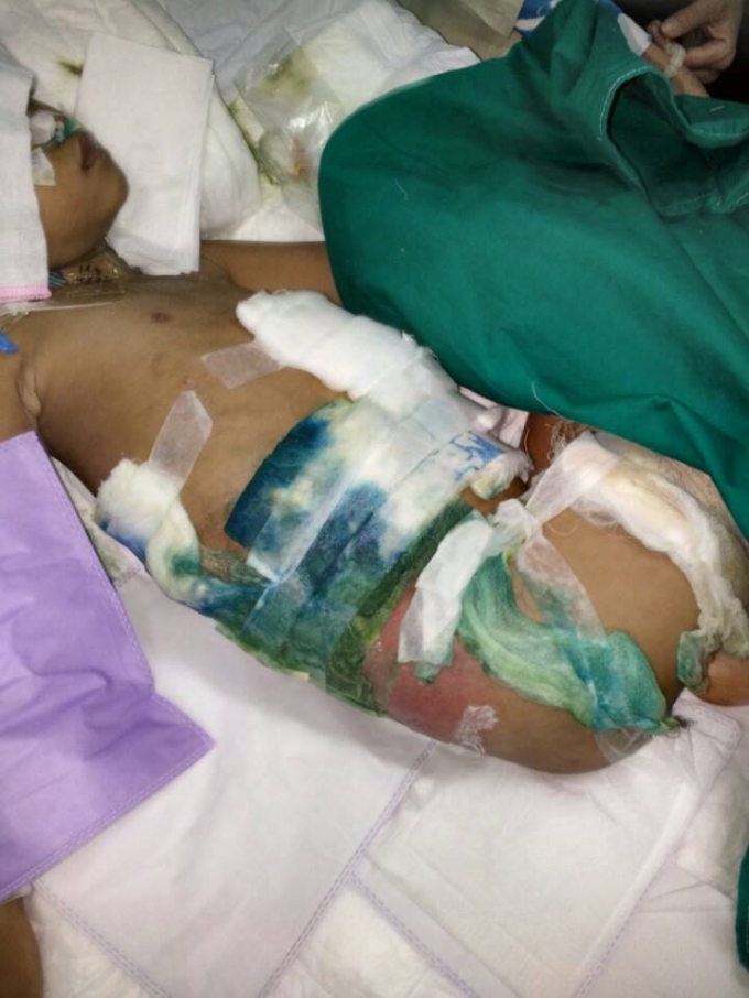 B&eacute; nằm vật v&atilde; trong cơn đau thể x&aacute;c.