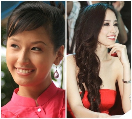 Hoa hậu Mai Phương Th&uacute;y trước khi đăng quang sở hữu l&agrave;n da ngăm đen v&agrave; h&agrave;m răng kh&ocirc;ng đều. Ảnh: internet.