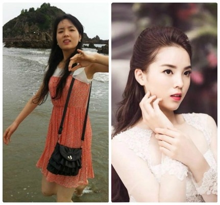 L&agrave;n da đen nhẻm v&agrave; th&acirc;n h&igrave;nh gầy g&ograve; khiến mọi người thật ngỡ ng&agrave;ng.Ảnh: internet.