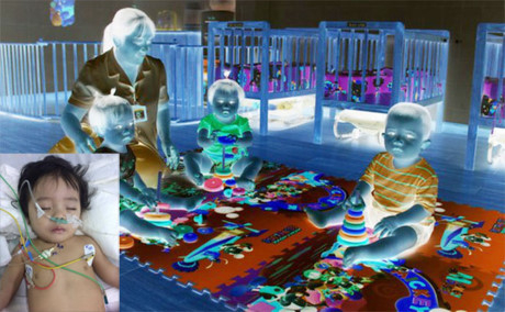 B&eacute; g&aacute;i 13 th&aacute;ng tuổi chấn thương sọ n&atilde;o khi gửi nh&agrave; trẻ tư