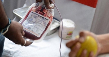 Loại bỏ phương án 