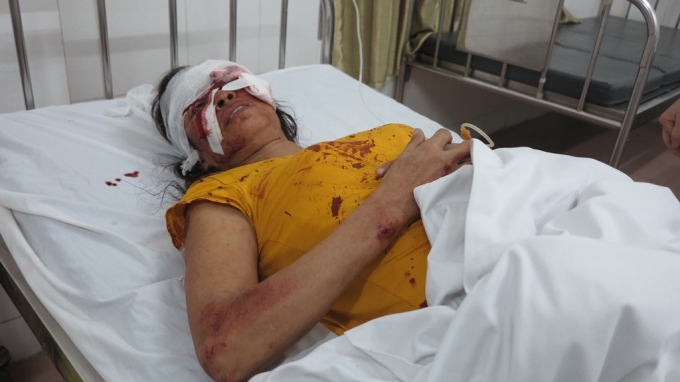 Trong đ&oacute; c&oacute; một số h&agrave;nh kh&aacute;ch bị thương nặng.