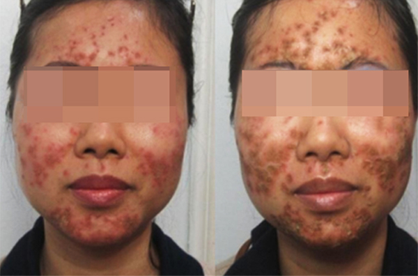 Kỳ 1 - L&agrave;m r&otilde; nghi vấn mỹ phẩm My Miu quảng c&aacute;o kh&ocirc;ng đ&uacute;ng sự thật