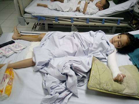 Hiền Minh với nghị lực phi thường, vượt qua nỗi đau khiến người kh&aacute;c y&ecirc;n t&acirc;m. (Ảnh: Th&agrave;nh L&acirc;m)