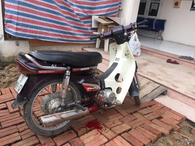 Do bị đạn nổ tr&uacute;ng đ&ugrave;i, nam thanh ni&ecirc;n bị chảy nhiều m&aacute;u.