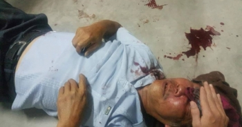 Cụ ông 68 tuổi bị bảo vệ chung cư SaiGon Metro Park hành hung dã man