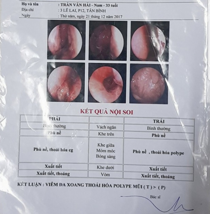 Phiếu ghi nhận kết quả kh&aacute;m tại ph&ograve;ng kh&aacute;m của anh Hải