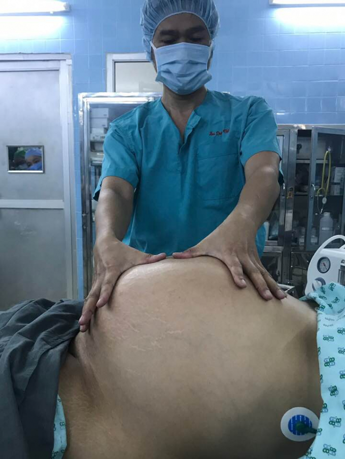 Người phụ nữ c&oacute; v&ograve;ng bụng to 120cm.