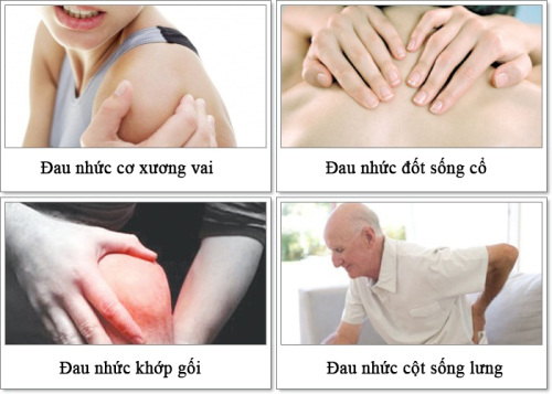 C&aacute;c dạng đau nhức của bệnh li&ecirc;n quan đến xương khớp