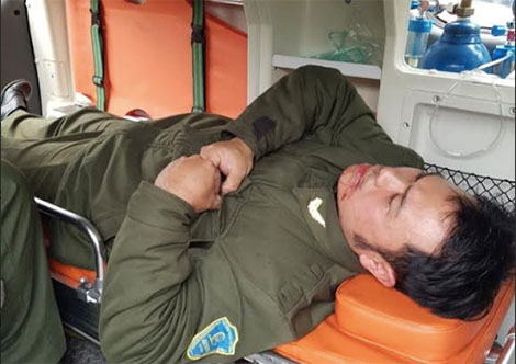 Anh Nguyễn Văn Điệp sau khi bị h&agrave;nh hung.