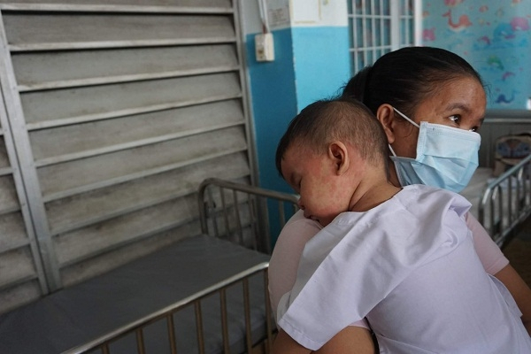 Một b&eacute; trai mắc bệnh sởi kh&aacute; nặng được mẹ &ocirc;m v&agrave;o l&ograve;ng -&nbsp;Ảnh: PV