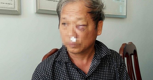 Truy bắt 2 kẻ côn đồ hành hung nhà báo VTV