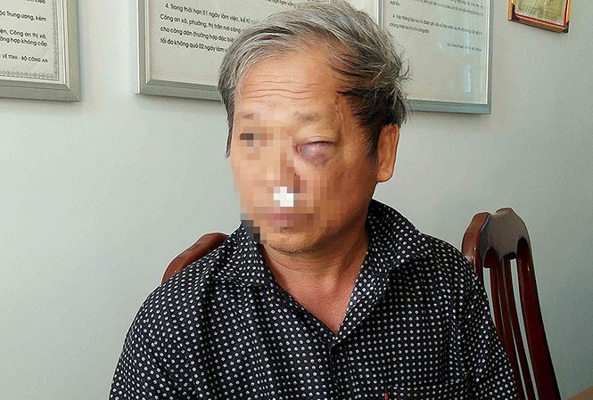 Nh&agrave; b&aacute;o Chiểu tại cơ quan điều tra (ảnh: Tiền Phong).