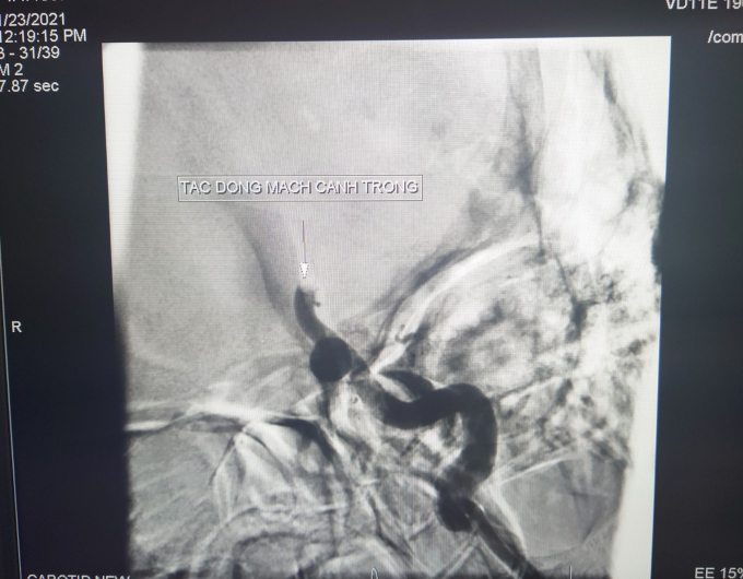 a82e050e1ff0efaeb6e1