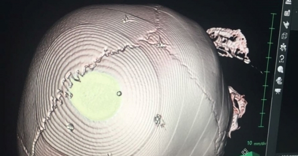 Cục trẻ em đề nghị điều tra vụ bé gái 3 tuổi nghi bị bạo lực ở huyện Thạch Thất