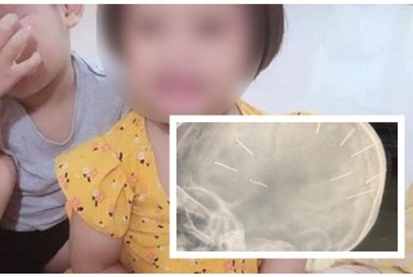 tre5-1642937886123-16429378863562094509649