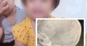 COVID-19 kẻ “tiếp tay” cho các vụ bạo hành trẻ em