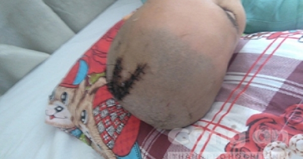 Con rể ngoại quốc dùng dao truy sát gia đình vợ lúc rạng sáng