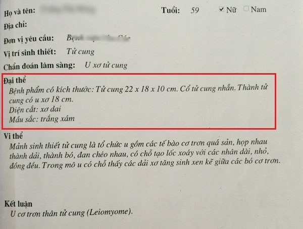 Kết quả giải phẫu của b&agrave; H được kh&aacute;m tại một bệnh viện đa khoa tại H&agrave; Nội. Ảnh: Bệnh viện cung cấp.
