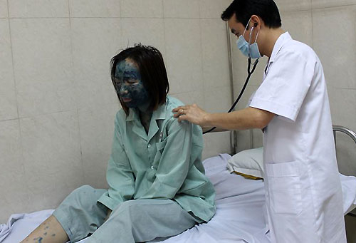 Người lớn mắc thủy đậu thường nặng v&agrave; dễ biến chứng hơn trẻ. Ảnh:&nbsp;T.X/VnExpress.