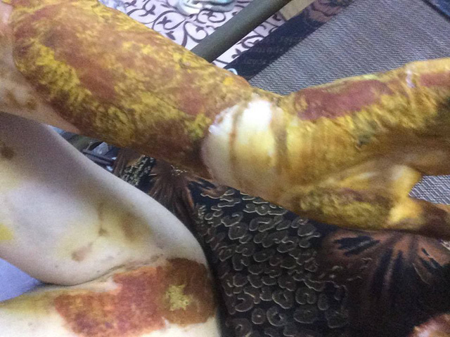 Nh&agrave; trường xin lỗi Diệp Anh sau vụ xảy ra nổ cồn trong ph&ograve;ng thực h&agrave;nh H&oacute;a khiến em bị bỏng.