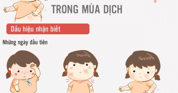 Inforgraphics: Bí kíp sống khỏe giữa mùa dịch thủy đậu