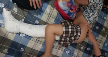 Bộ trưởng Phùng Xuân Nhạ yêu cầu sớm kết luận vụ học sinh bị xe đâm gãy chân