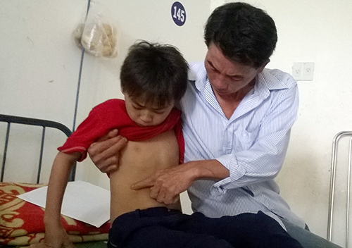 Nam sinh lớp 3 bị đ&aacute;nh đang điều trị tại Trung t&acirc;m Y tế huyện. Ảnh:&nbsp;T.L