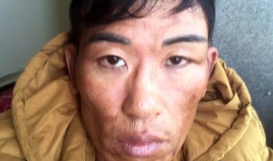 Phá lãnh địa ma túy của Khiêm “pê đê”