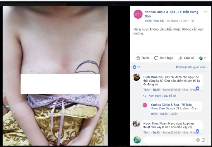 Một cảnh quảng c&aacute;o phẫu thuật n&acirc;ng ngực tại&nbsp;Yanhee Clinic &amp;amp;amp; Spa.