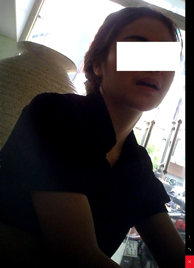 Người t&ecirc;n T. xưng l&agrave; b&aacute;c sỹ trực tiếp tư vấn dịch vụ phẫu thuật thẩm mỹ cho ph&oacute;ng vi&ecirc;n.