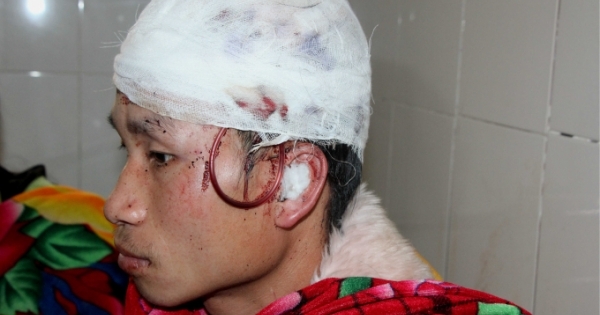 Bị gấu tấn công khi vào rừng lấy lá dong, người đàn ông giả chết để thoát nạn